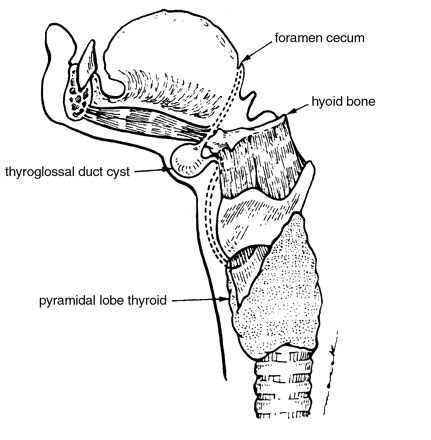 Diagram showing where thyroglossal duct cysts occur