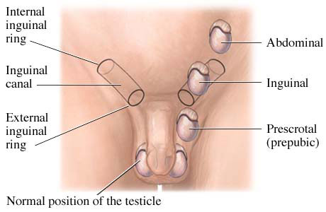 Diagram showing normal position of the testicle